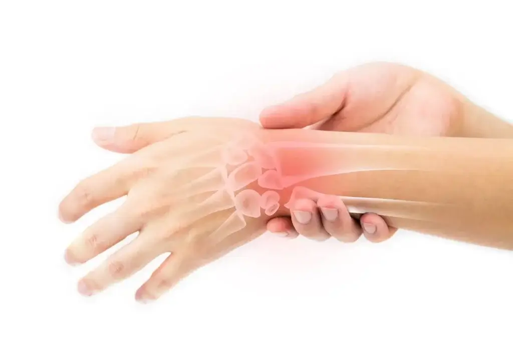 Treatments For Carpal Tunnel Syndrome - Orthopaedic Specialty Group